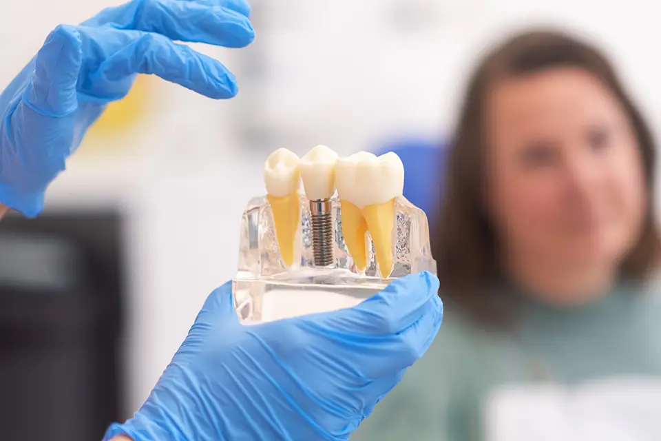 Top Benefits of Dental Implants You Should Know