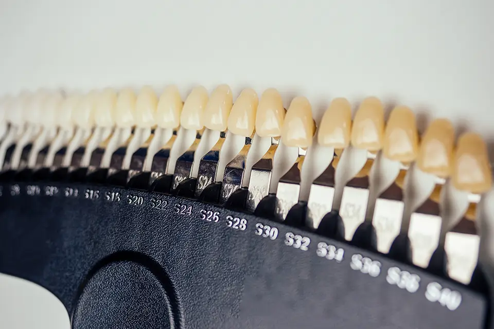 The Different Types of Dental Crowns and Their Uses