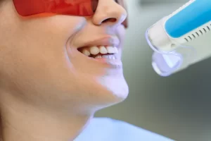 Professional Teeth Whitening Services in Etobicoke