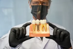 Durable Dental Implants Etobicoke