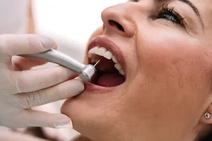 Professional Dental Cleaning Services in Etobicoke