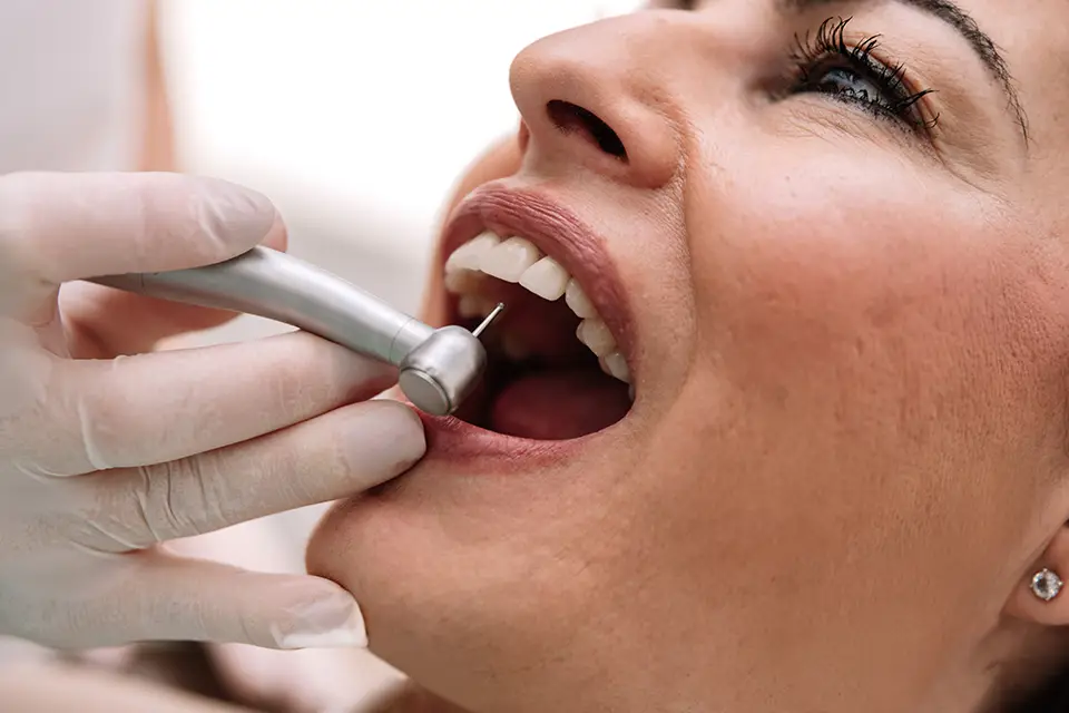 Professional Dental Cleaning Services in Etobicoke