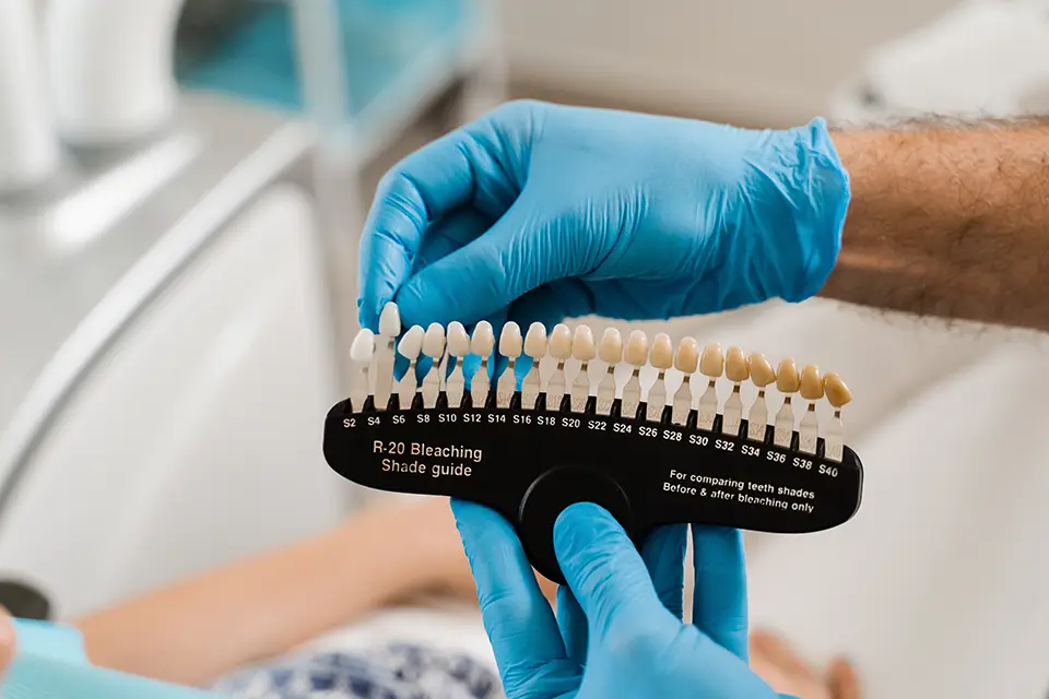 Pros and Cons of Veneers: Alternatives to Veneers (And When They're Smarter)