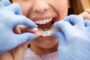 Invisalign Etobicoke: Straighten Your Teeth with Confidence