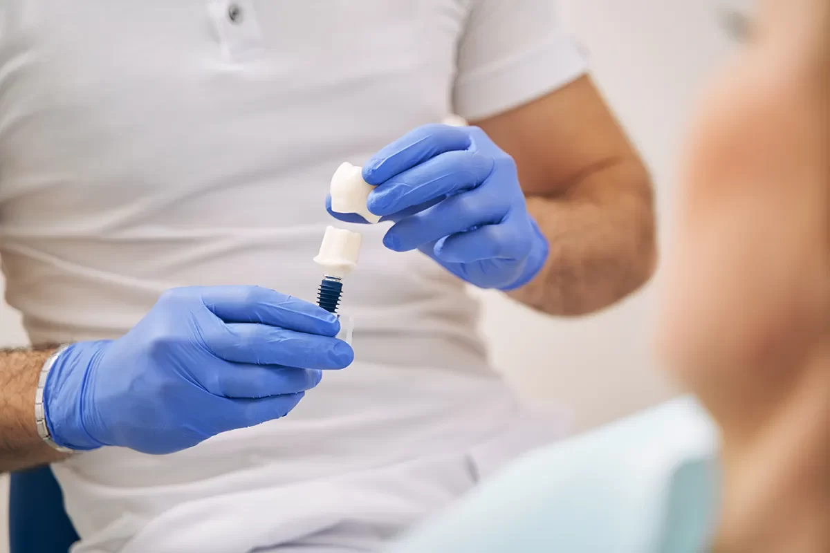 Dental Implants - 02