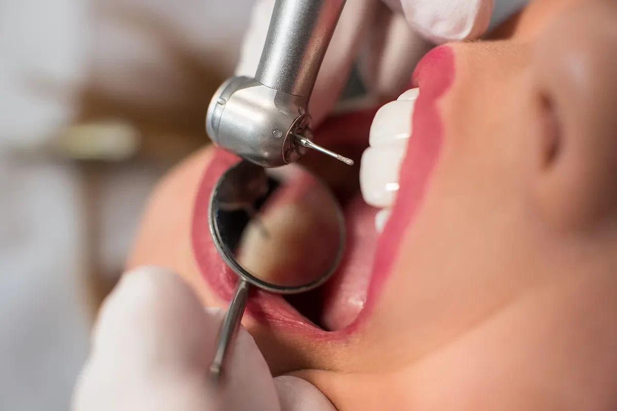 Dentist in Mimico - 02