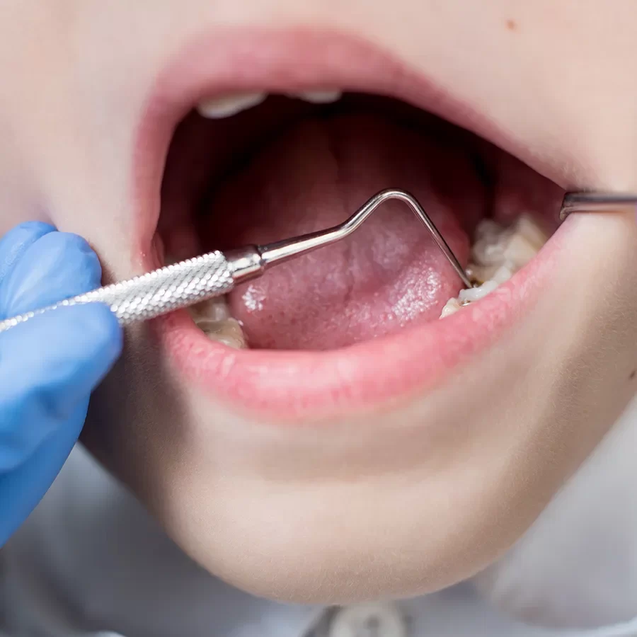 Dentist in Mimico - 03