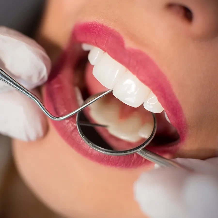 Dentist in New Toronto - 03