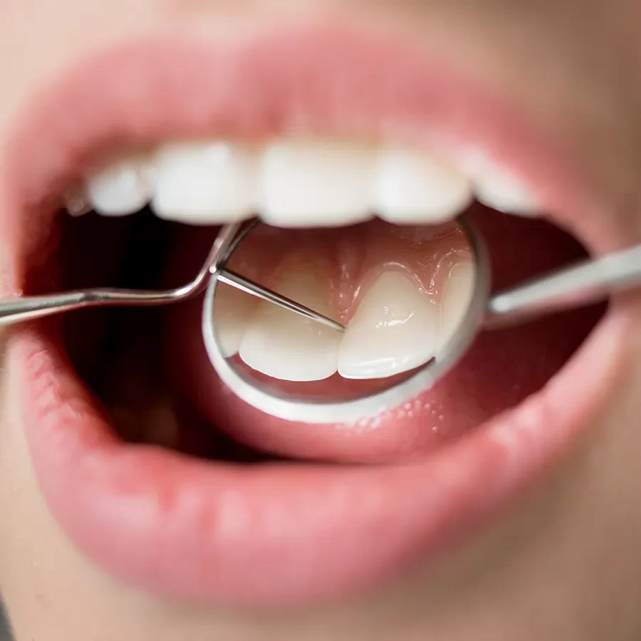 Dentist in Stonegate-Queensway - 03