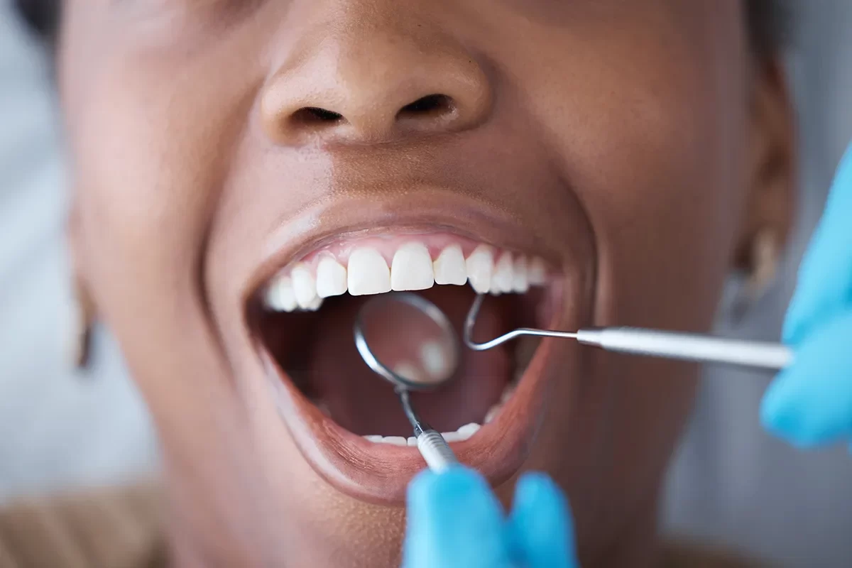 Sedation Dentistry - 07