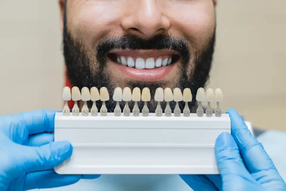 A Closer Look at the Main Types of Dental Crowns