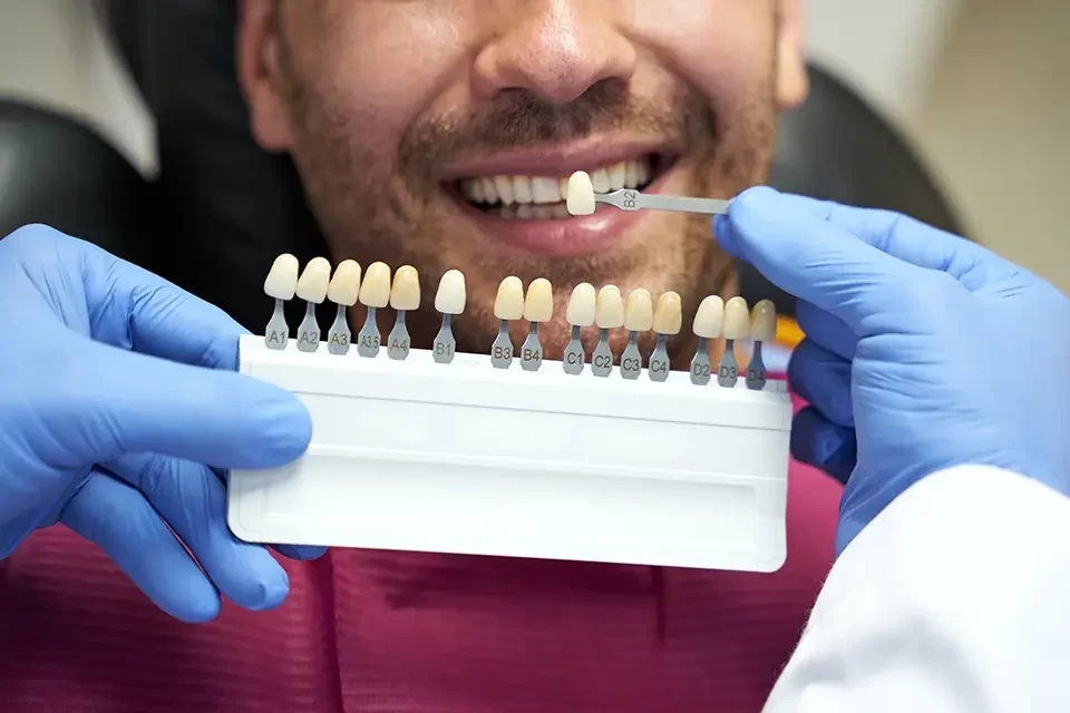 Why Are There Different Types of Dental Crowns?