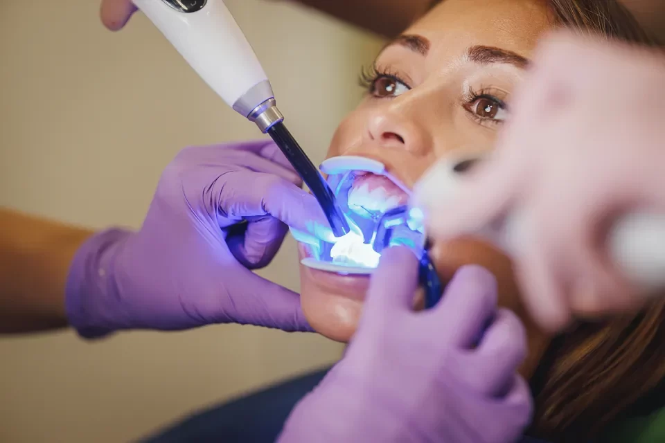 How to Pick the Best Teeth Whitening in Etobicoke