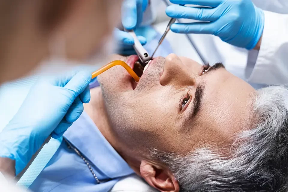 The Telltale Signs You Need a Root Canal
